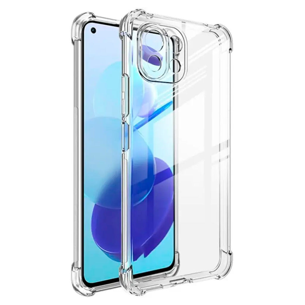 Чехол (накладка) Xiaomi 17, GETMAN Ease logo, Прозрачный - № 1 Чехол (накладка) Xiaomi 17, GETMAN Ease logo, Прозрачный - № 1